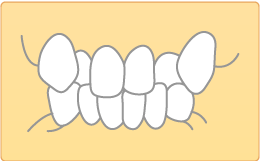 掛川市・すずき歯科