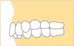 掛川市・すずき歯科