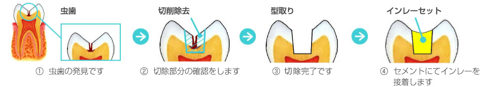 掛川市・すずき歯科